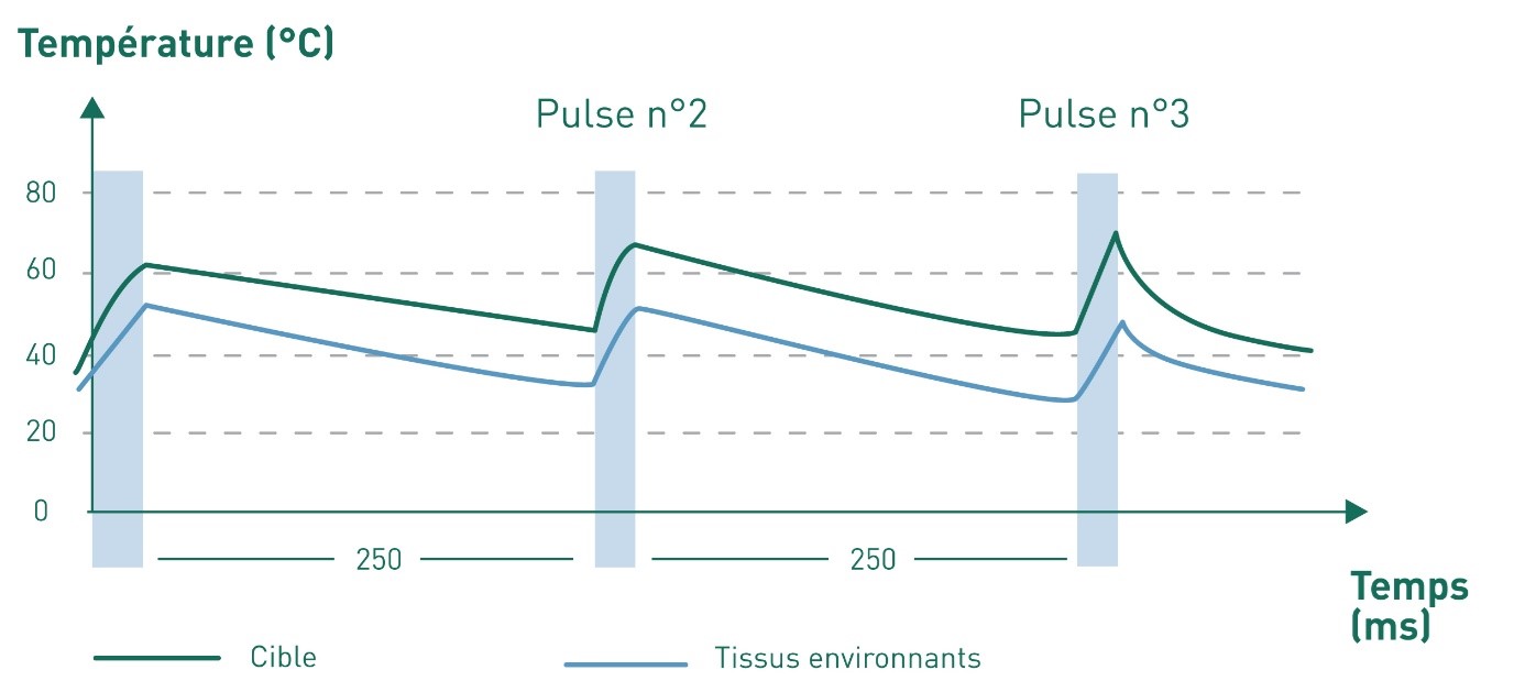 Technologie multipulse